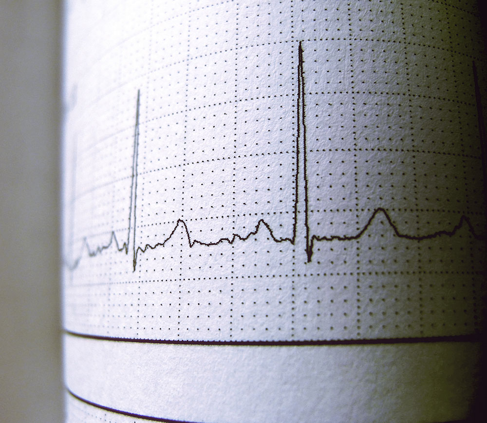 CARDIOLOGIA