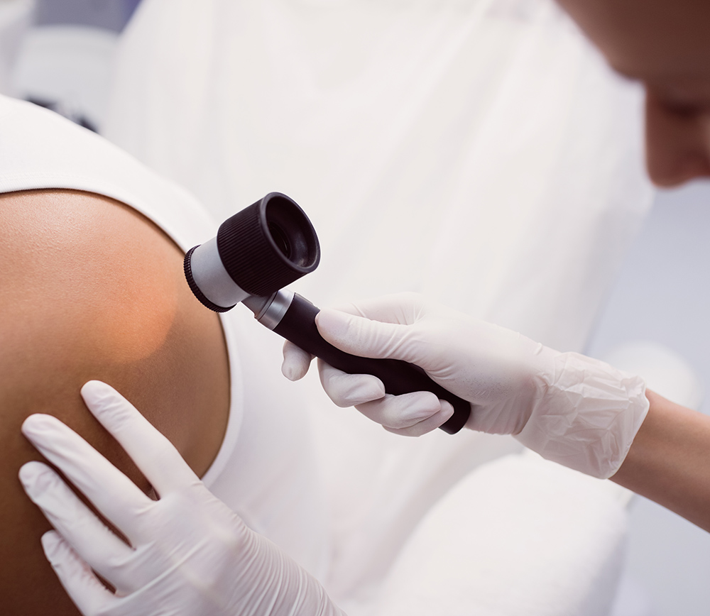 Doctor removing mole with laser treatment in clinic